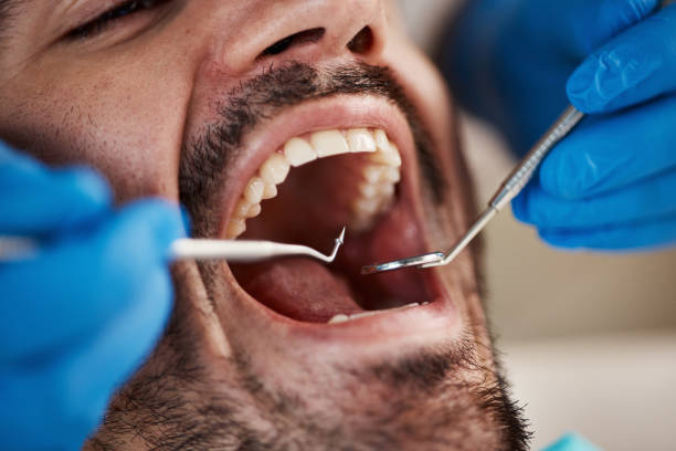 Tooth Infection Emergency Dentist in MA